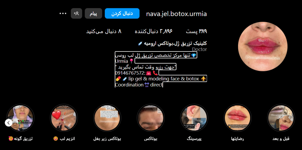 کلینیک نوا ژل